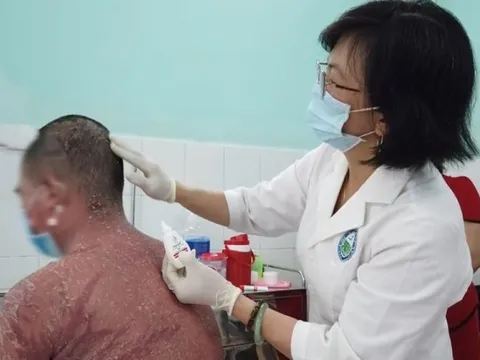 Thêm nhiều trường hợp nhập viện do sử dụng thuốc chữa vảy nến trên mạng
