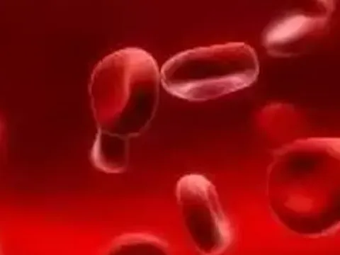 Mỹ phê duyệt loại thuốc đắt nhất thế giới, giá 3,5 triệu USD/liều