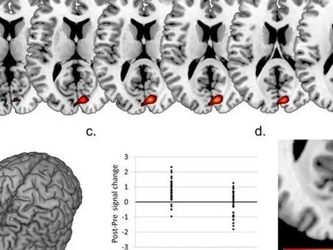 Não phụ nữ có biến lớn khi mang thai