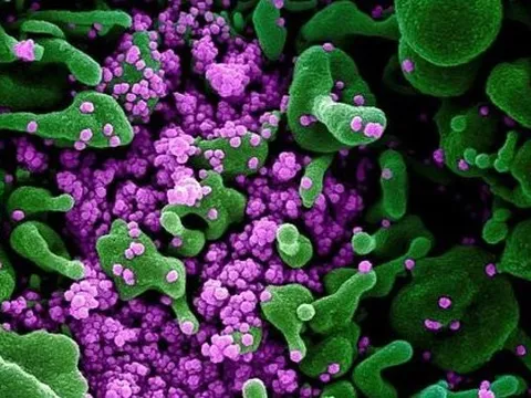 Phát hiện biến chủng COVID-19 mới BW.1 mang 54 đột biến, lan nhanh ở Mexico