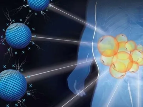 Phương pháp điều trị béo phì hiệu quả