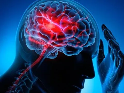 Phòng đột quỵ khi thời tiết thay đổi như thế nào?