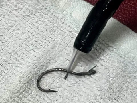 Cụ ông 83 tuổi mắc lưỡi câu trong thực quản