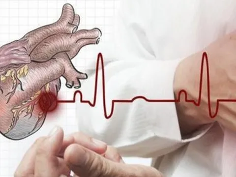 Tử vong do bệnh tim mạch ngày càng tăng