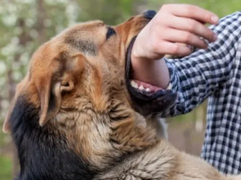 Đang khỏe mạnh, thanh niên lên cơn dại tử vong sau 4 tháng bị chó lạ cắn