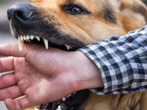 Người đàn ông nguy kịch sau khi bị chó lạ cắn