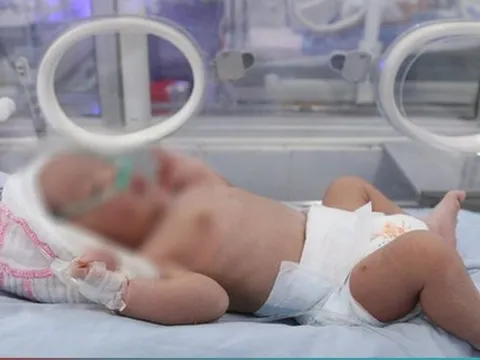 Cấp cứu bé sơ sinh mắc dị tật bẩm sinh bị bỏ rơi trong trời giá rét