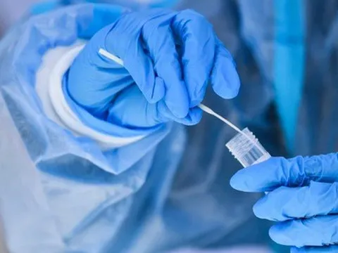 Bộ Y tế: Dịch COVID-19 sẽ diễn biến phức tạp với biến thể XBB