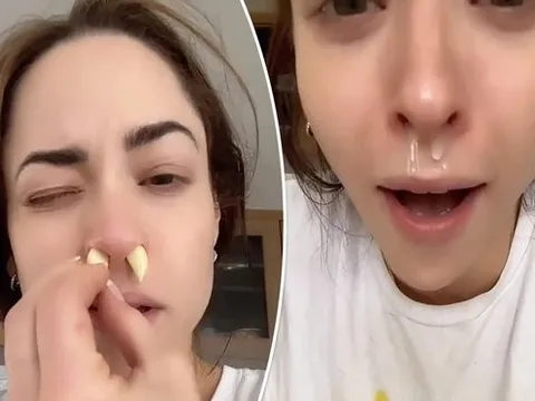 Nhét tỏi vào mũi để làm sạch xoang, chữa cảm cúm, chuyên gia nói 'càng tồi tệ hơn'