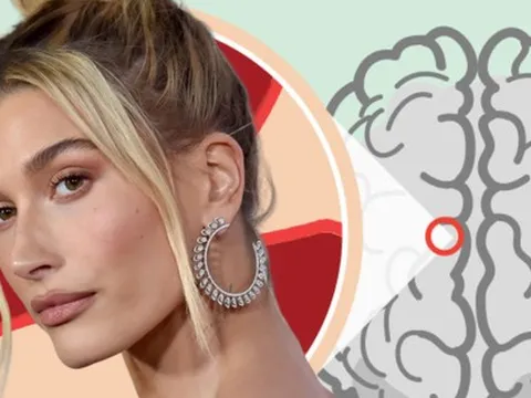 Trải nghiệm thoát chết khỏi cơn đột quỵ của Hailey Bieber: Cảnh giác với 4 dấu hiệu nhận biết