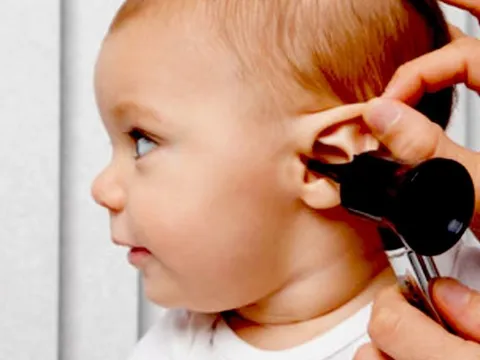 Vì sao không nên cho trẻ bị viêm tai giữa uống aspirin?