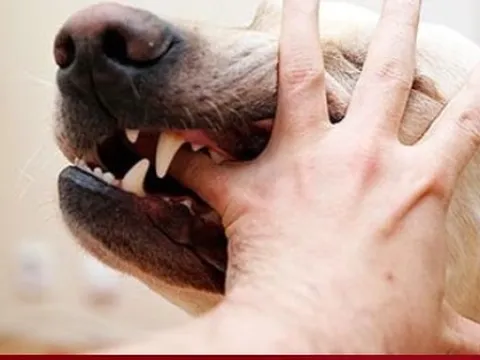 Tử vong vì bệnh dại sau khi bị chó cắn 4 tháng trước