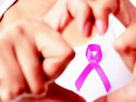 Ung thư sẽ không dám ‘gõ cửa’ nếu bạn có 5 thói quen này: Cái cuối cùng nhiều người thường quên