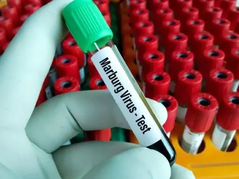 Virus khiến 9 người chết sau khi đi dự đám tang lây lan như thế nào?