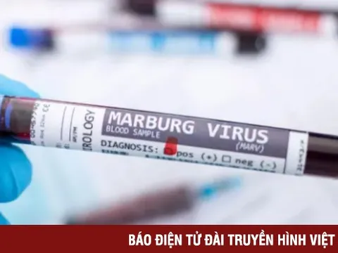 WHO họp khẩn vì ổ dịch sốt xuất huyết do virus Marburg