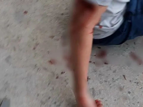 Khánh Hòa: Xác minh vụ du khách nước ngoài bị chó cắn nhập viện