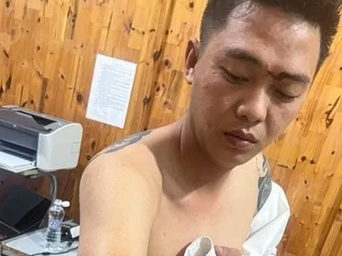 Bắt giữ đối tượng chém Phó Trưởng Công an xã trọng thương
