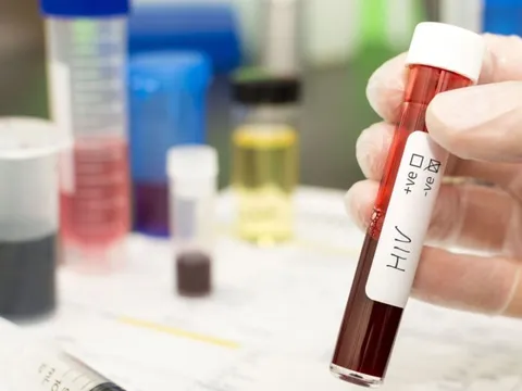 Người thứ 5 trên thế giới được chữa khỏi HIV