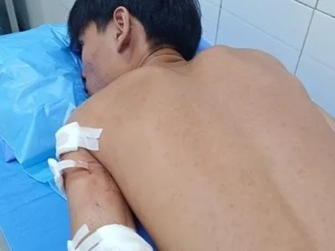 Bình Thuận: Điều tra vụ một học sinh bị nhóm thanh niên dùng dao đâm trước trường