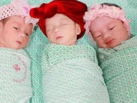 Hà Nội: Mổ đẻ thành công ca sinh 3 tự nhiên cùng trứng hiếm gặp