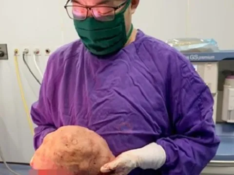 Phẫu thuật thành công cho người phụ nữ có ngực trái to gấp 10 lần bình thường