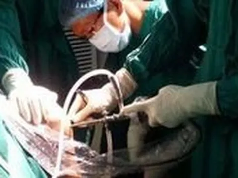 NHỮNG ĐÔI TAY VÀNG CỦA NGÀNH Y (*): Mất ngón tay, không buông dao mổ