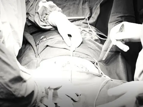 Có dấu hiệu này khi quan hệ tình dục, coi chừng mắc ung thư