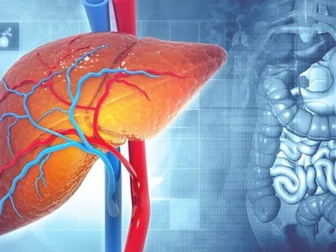 3 dấu hiệu trên da cảnh báo gan nhiễm mỡ nặng