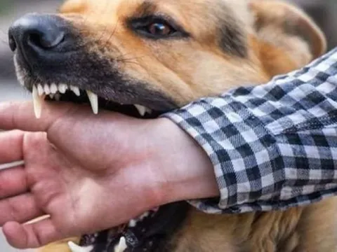 Sau 18 tháng bị chó nhà cắn vào tay, cô gái 23 tuổi tử vong