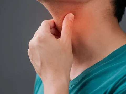 2 thói quen hầu hết đàn ông đều mắc, là nguyên nhân tăng nguy cơ mắc ung thư thực quản