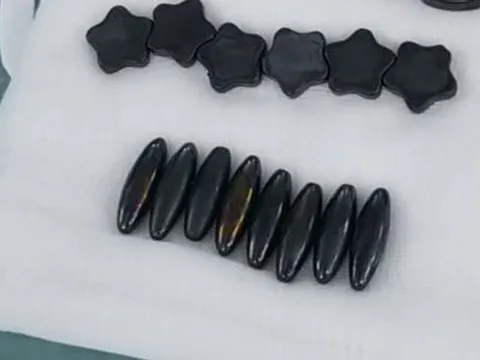 Bé trai nuốt 20 viên nam châm vì nghĩ là kẹo