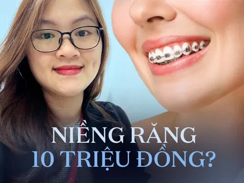 Cơn sốt 'Niềng răng từ A đến Z giá rẻ dưới 10 triệu đồng', bác sĩ cảnh báo