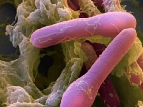 Độc tố Botulinum nguy hiểm như thế nào?