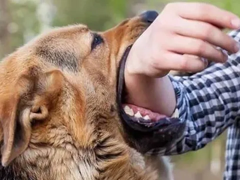 Nghệ An: Liên tiếp có 2 trẻ nhỏ tử vong thương tâm sau khi bị chó cắn