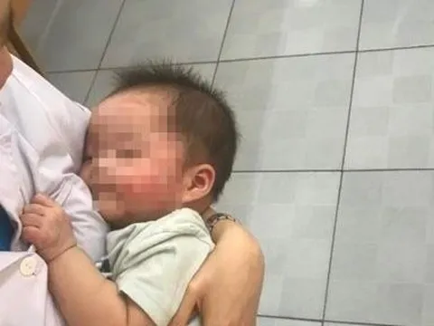 Xót xa bé gái 7 tháng tuổi bị bỏ rơi vệ đường, người chi chít vết muỗi đốt