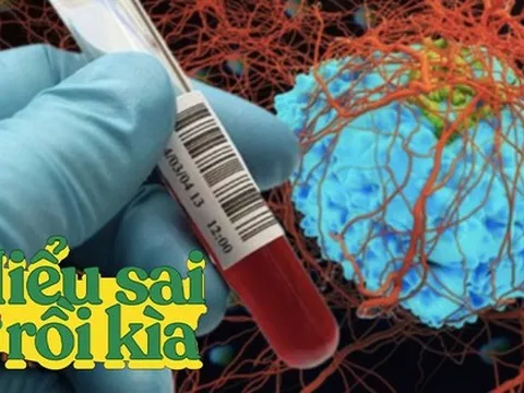 Xét nghiệm máu có thể phát hiện sớm được bệnh ung thư không? Bác sĩ giải đáp sự thật phía sau