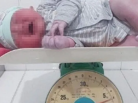 Hà Tĩnh: Bé trai sơ sinh chào đời với cân nặng “khủng” 6kg