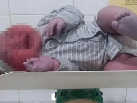 Sản phụ 28 tuổi sinh bé trai nặng hơn 6 kg