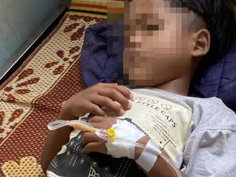 Sau khi ăn thịt cóc mẹ làm, 2 bé ngộ độc, 1 bé tử vong