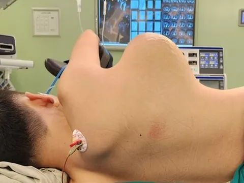 Nam thiếu niên 16 tuổi từ TP HCM ra Hà Nội bóc khối u ngực khủng