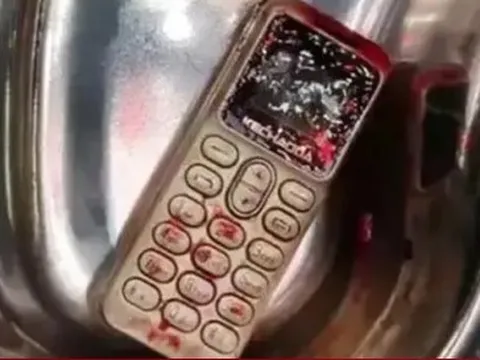 Cãi nhau với em trai, chị gái nuốt luôn điện thoại vào bụng