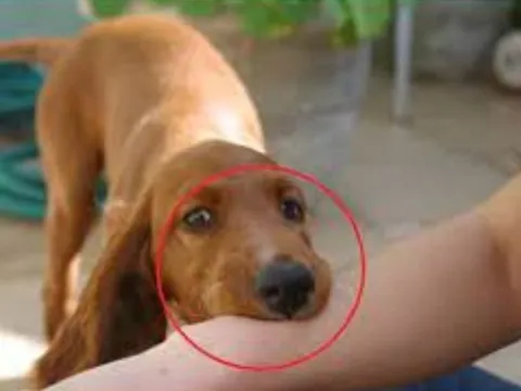 Bé gái 9 tuổi tử vong sau 2 tháng bị chó cắn vào tay