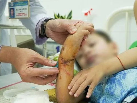 Chợ Rẫy kích hoạt báo động đỏ nối bàn tay đứt lìa