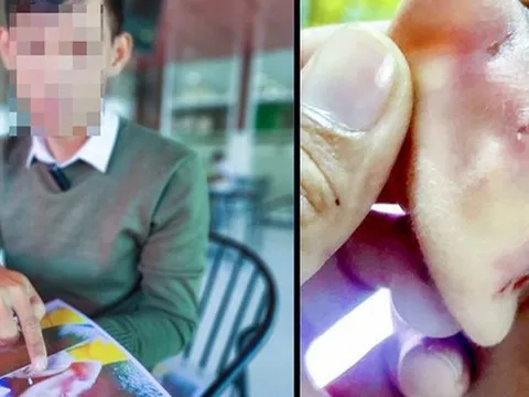 Nhiều trẻ em bị bạo hành, xâm hại được các cơ sở khám chữa bệnh phát hiện