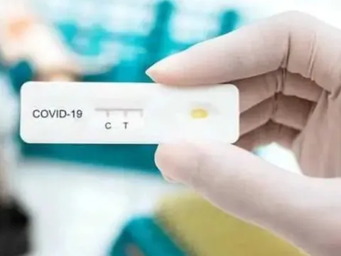 Số ca mắc Covid-19 gia tăng: Làm sao để phân biệt với các bệnh hô hấp khác, làm gì khi mắc bệnh?