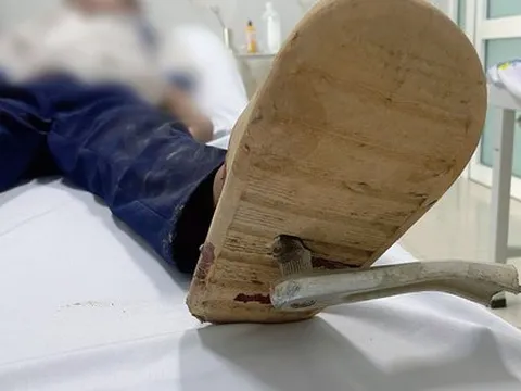 Bé trai bị thanh sắt đâm xuyên bàn chân