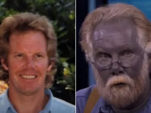 Người đàn ông có làn da như “người ngoài hành tinh” vì loại bệnh lạ quái ác