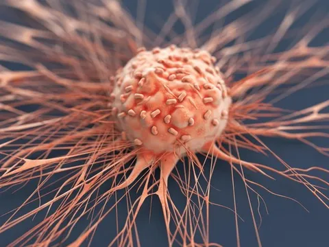 Thói quen xấu vào buổi sáng có thể 'dẫn lối' cho ung thư và bệnh tim