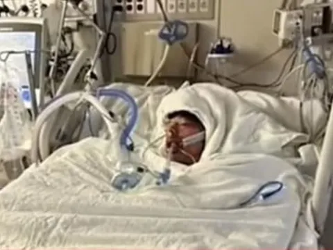 Nghịch dại theo thử thách trên TikTok, nam sinh 16 tuổi bỏng 75% cơ thể