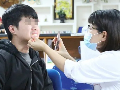 Đi nhổ răng khôn phát hiện căn bệnh nguy hiểm, nam sinh 'giật mình' khi nghĩ lại dấu hiệu cảnh báo trước đó